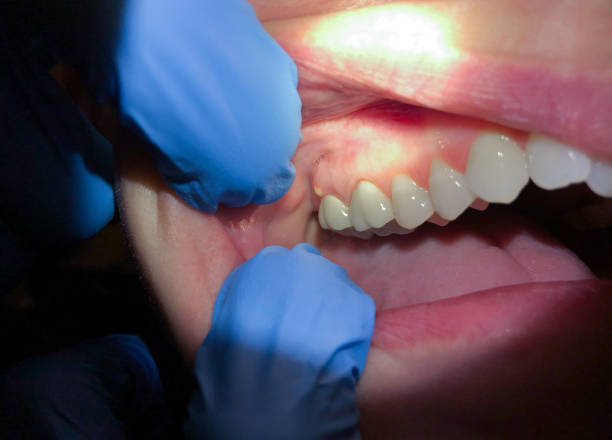 Best Dental Emergency Near Me  in Village Of The Branch, NY