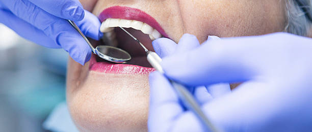 Best Teeth Whitening  in Village Of The Branch, NY
